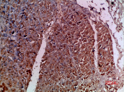 Immunohistochemical analysis of paraffin-embedded human-pancreas, antibody was diluted at 1:200