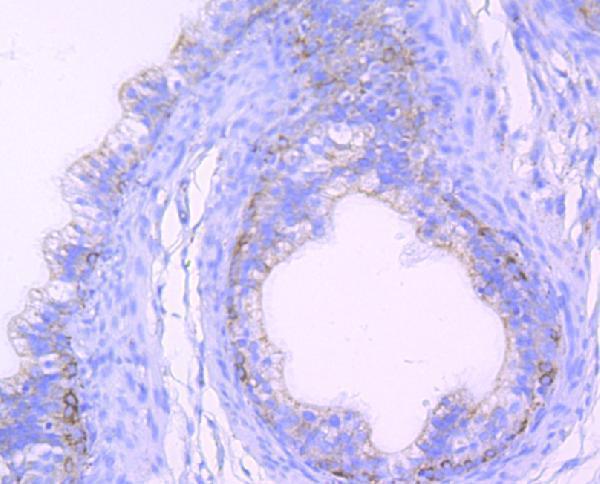Immunohistochemical analysis of paraffin-embedded rat epididymis tissue using anti-Citrate synthetase antibody