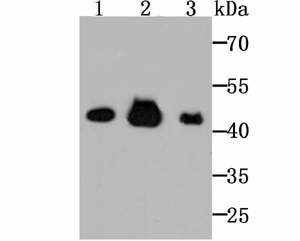 Western blot analysis of Citrate synthetase on Hela cell using anti-Citrate synthetase antibody at 1/1,000 dilution