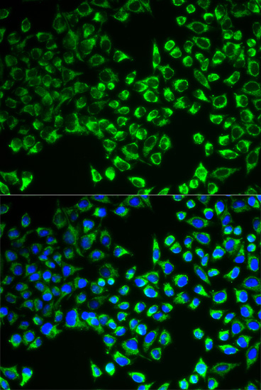 Confocal immunofluorescence analysis of U2OS cells using CS Polyclonal Antibody  at dilution of 1:100