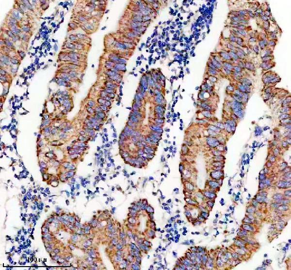 IHC analysis of DAP3 using anti-DAP3 antibody (A05131-3)