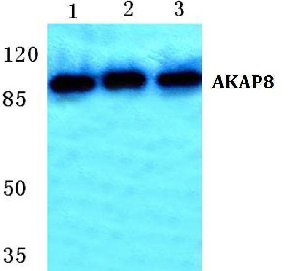 Western blot (WB) analysis of AKAP8 polyclonal antibody at 1:500 dilution
Lane1:HepG2 cell lysate
Lane2:Mouse kidney tissue lysate
Lane3:Rat kidney tissue lysate