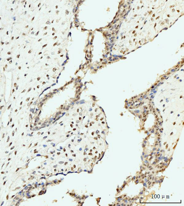  IHC analysis of AKAP 95/AKAP8 using anti-AKAP 95/AKAP8 antibody (A05133-2)