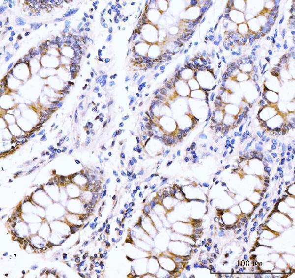 a05133 2 akap8 primary antibodies ihc testing 5