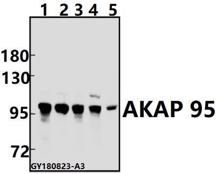 Western blot (WB) analysis of AKAP 95 (E363) pAb at 1:500 dilution
Lane1:EC9706 whole cell lysate(40ug)
Lane2:HepG2 whole cell lysate(40ug)
Lane3:HEK293T whole cell lysate(40ug)
Lane4:AML-12 whole cell lysate(40ug)
Lane5:H9C2 whole cell lysate(40ug)