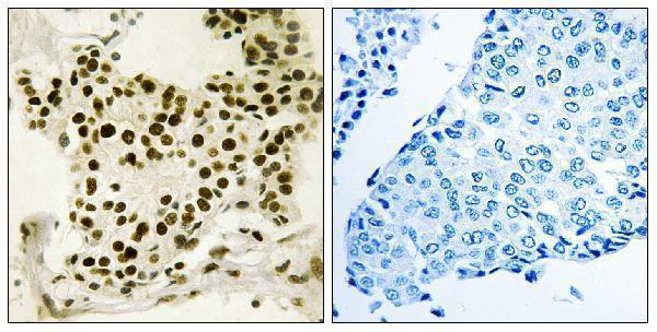 a05134s484 ubtf primary antibodies ihc testing 1