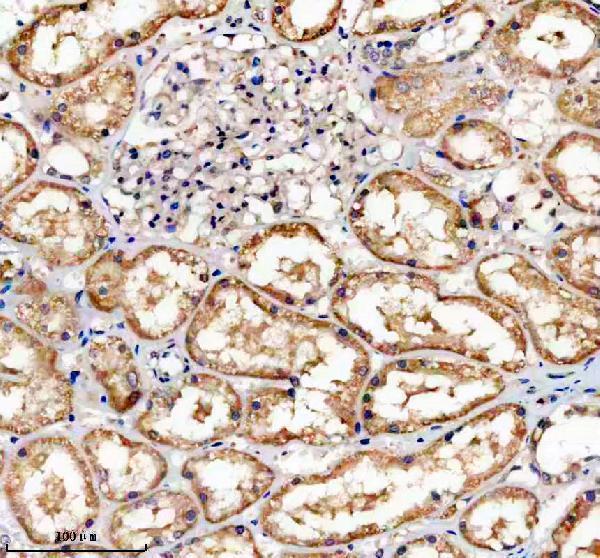 IHC analysis of DCR2/TNFRSF10D using anti-DCR2/TNFRSF10D antibody (A05136-2)