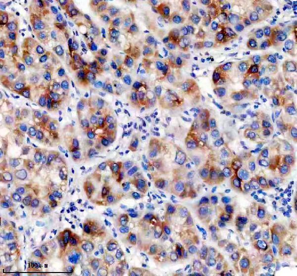 IHC analysis of DCR2/TNFRSF10D using anti-DCR2/TNFRSF10D antibody (A05136-2)