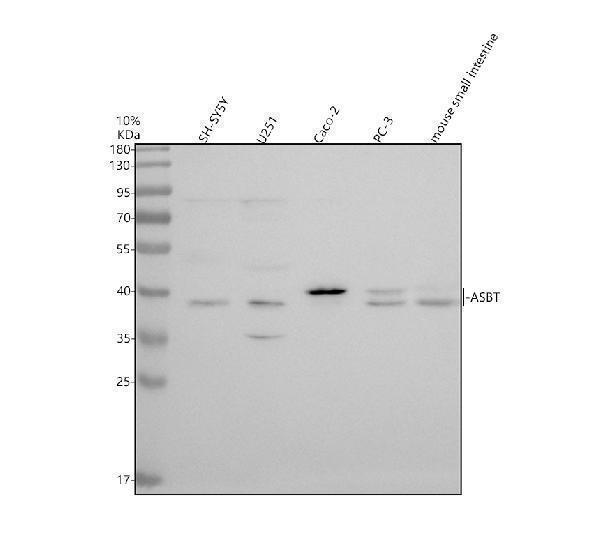 Western blot analysis of ASBT using anti-ASBT antibody (A05138-4)