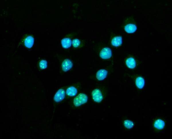  IF analysis of CENPB using anti-CENPB antibody (A05140-1)