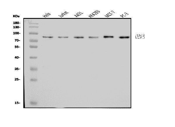  Western blot analysis of CENPB using anti-CENPB antibody (A05140-1)