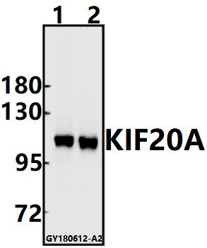 Western blot (WB) analysis of KIF20A (I524) pAb at 1:500 dilution
Lane1:SGC7901 whole cell lysate(10ug)
Lane2:EC9706 whole cell lysate(10ug)