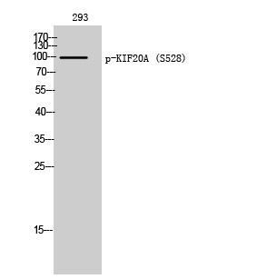 Western Blot analysis of 293 cells using Phospho-KIF20A (S528) Polyclonal Antibody