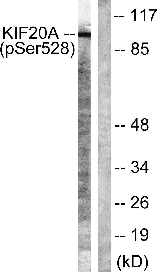Western blot analysis of lysates from 293 cells, using KIF20A (Phospho-Ser528) Antibody