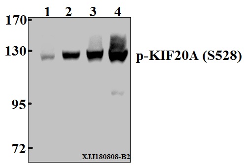 Western blot (WB) analysis of p-KIF20A (S528) pAb at 1:500 dilution
Lane1:PC12 whole cell lysate(40µg)
Lane2:The Testis tissue lysate of Mouse(40µg)
Lane3:SK-OVCAR3 whole cell lysate(40µg)
Lane4:Myla2059 whole cell lysate(40µg)