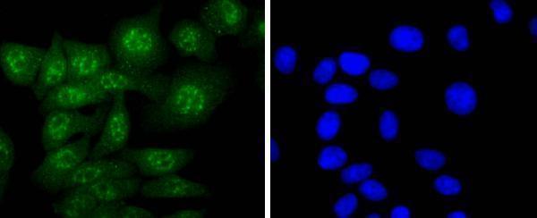 a05143 casp14 primary antiboties icc testing 2