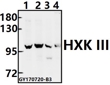 Western blot (WB) analysis of HXK III (V848) pAb at 1:500 dilution
Lane1:A549 whole cell lysate(40ug)
Lane2:H1792 whole cell lysate(40ug)
Lane3:AML-12 whole cell lysate(40ug)
Lane4:PC12 whole cell lysate(40ug)