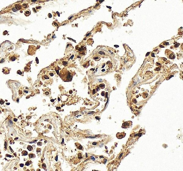 IHC analysis of HK3 using anti-HK3 antibody (A05145-3)