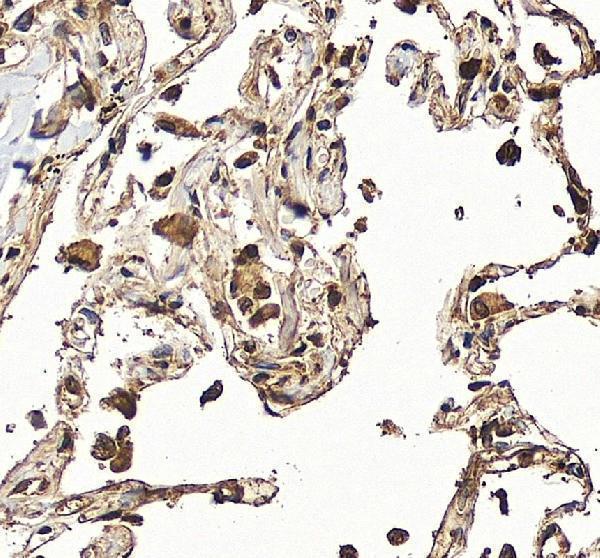 IHC analysis of HK3 using anti-HK3 antibody (A05145-3)