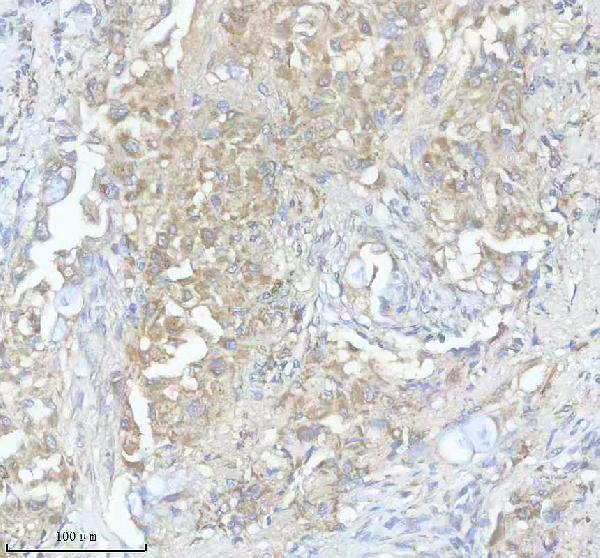 IHC analysis of NDUFV1 using anti-NDUFV1 antibody (A05146-2)