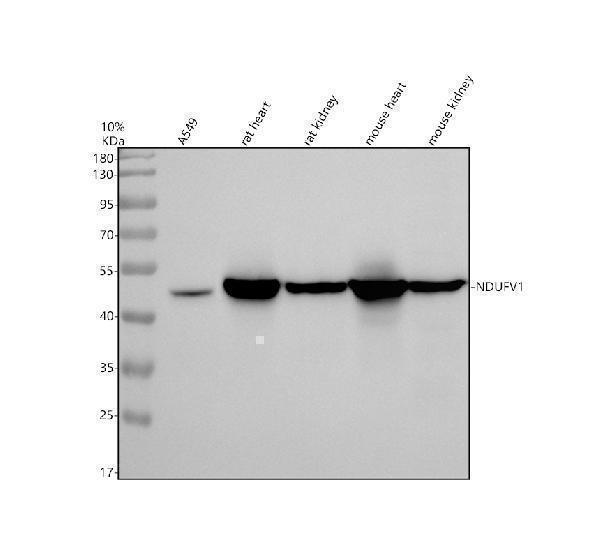 Western blot analysis of NDUFV1 using anti-NDUFV1 antibody (A05146-2)