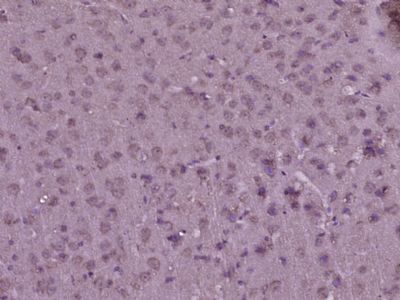 a05146 ndufv1 primary antiboties ihc testing 2