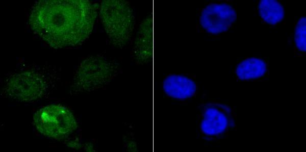 ICC staining Endo G in PC-3M cells (green)