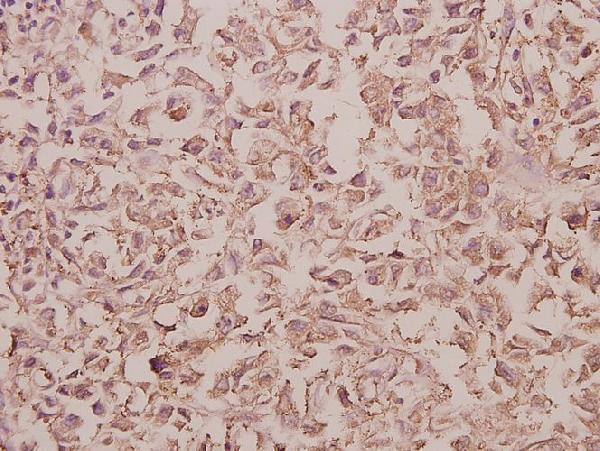 a05148 1 rab5c primary antiboties ihc testing 2