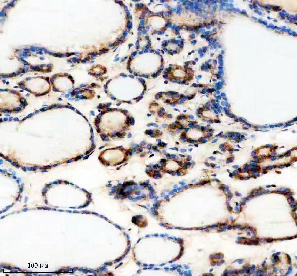 IHC analysis of THRAP3 using anti-THRAP3 antibody (A05150-1)