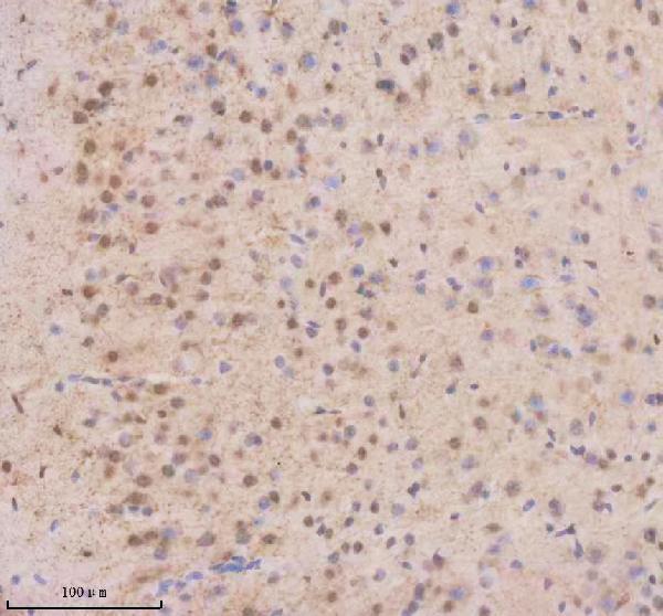 IHC analysis of THRAP3 using anti-THRAP3 antibody (A05150-1)