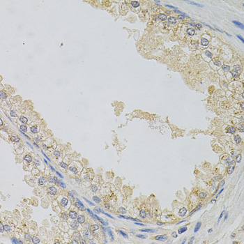 a05153 napa primary antiboties ihc testing 2