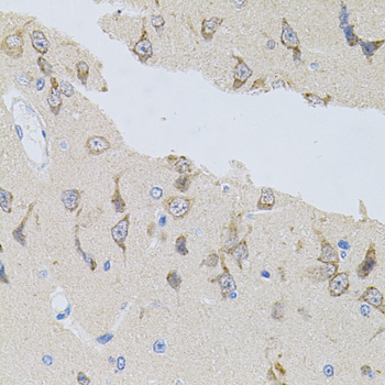 a05153 napa primary antiboties ihc testing 3