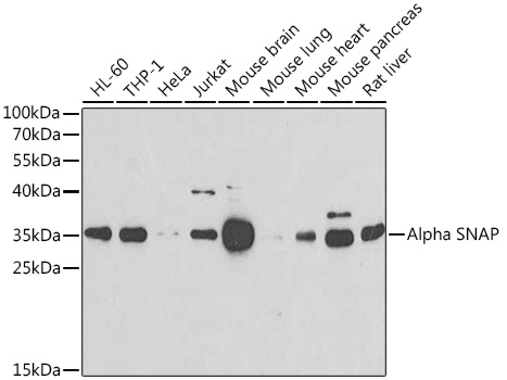 a05153 napa primary antiboties wb testing 1