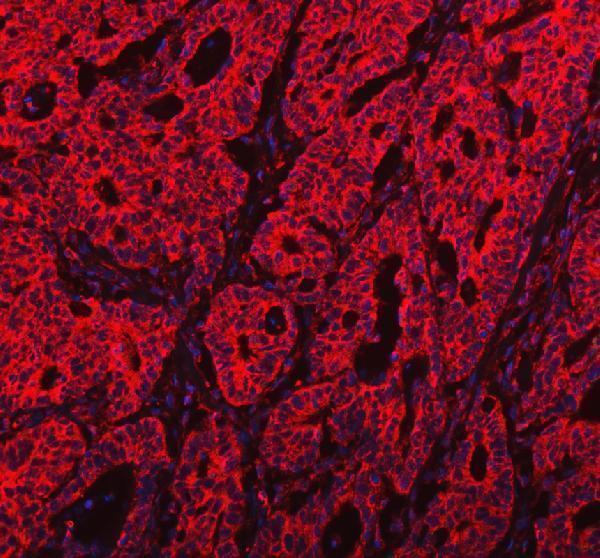 IF analysis of PKP3 using anti-PKP3 antibody (A05154-1)