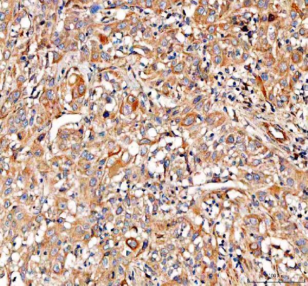 IHC analysis of PKP3 using anti-PKP3 antibody (A05154-1)