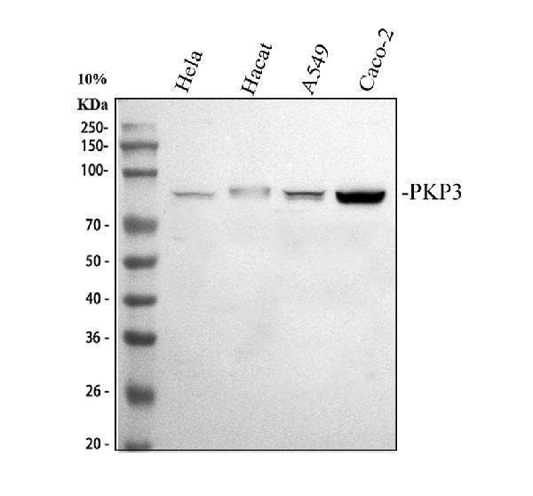 Western blot analysis of PKP3 using anti-PKP3 antibody (A05154-1)
