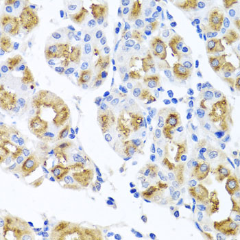 Immunohistochemistry of paraffin-embedded human stomach using FECH antibody  at dilution of 1:100 