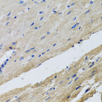 Immunohistochemistry of paraffin-embedded rat heart using FECH antibody  at dilution of 1:100 