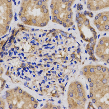 a05157 1 cdkn3 primary antiboties if testing 2