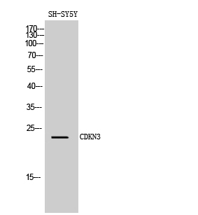 Western Blot analysis of SH-SY5Y cells using CDKN3 Polyclonal Antibody diluted at 1:1000