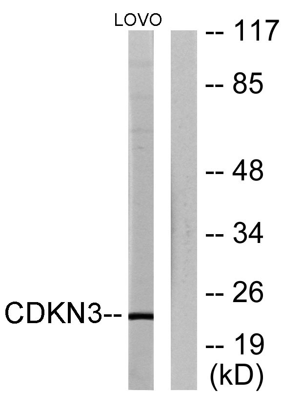 Western blot analysis of lysates from LOVO cells, using CDKN3 Antibody