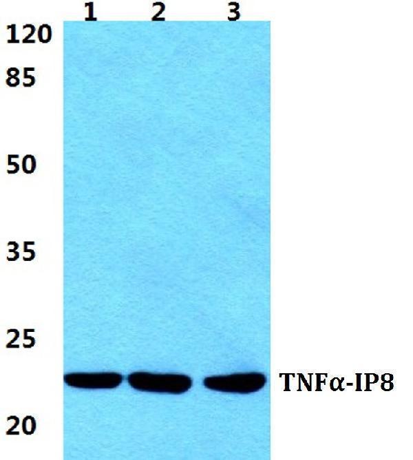 Western blot (WB) analysis of TNFα-IP8 polyclonal antibody at 1:500 dilution
Lane1:HEK293T cell lysate
Lane2:Raw264