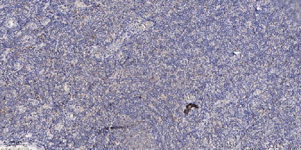 a05162 adck3 primary antibodies ihc testing 1