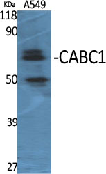 a05162 adck3 primary antibodies wb testing 2