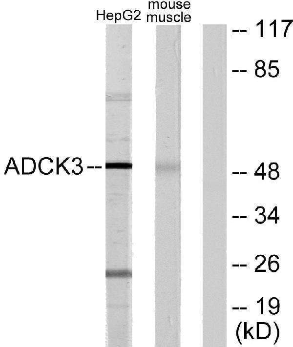 a05162 adck3 primary antibodies wb testing 4