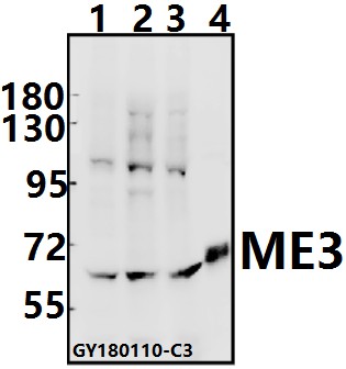 Western blot (WB) analysis of ME3 (R576) pAb at 1:500 dilution
Lane1:Panc1 whole cell lysate(40ug)
Lane2:A549 whole cell lysate(40ug)
Lane3:C6 whole cell lysate(40ug)
Lane4:The Testis tissue lysate of Mouse(10ug)