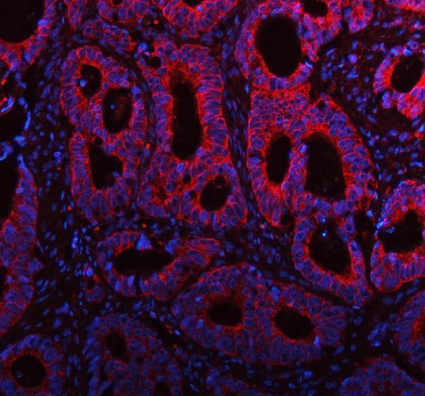 a05164 2 me3 primary antibodies if testing 13