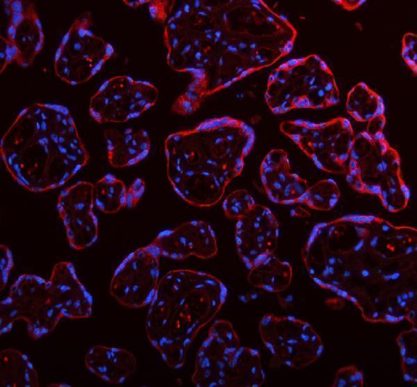 a05164 2 me3 primary antibodies if testing 14