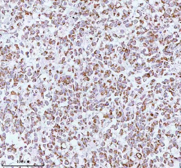 a05164 2 me3 primary antibodies ihc testing 11