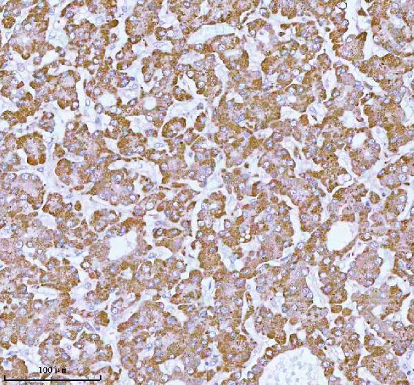  IHC analysis of ME3 using anti-ME3 antibody (A05164-2)